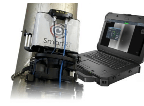 Digital Radiography (DR) SmartRT unit